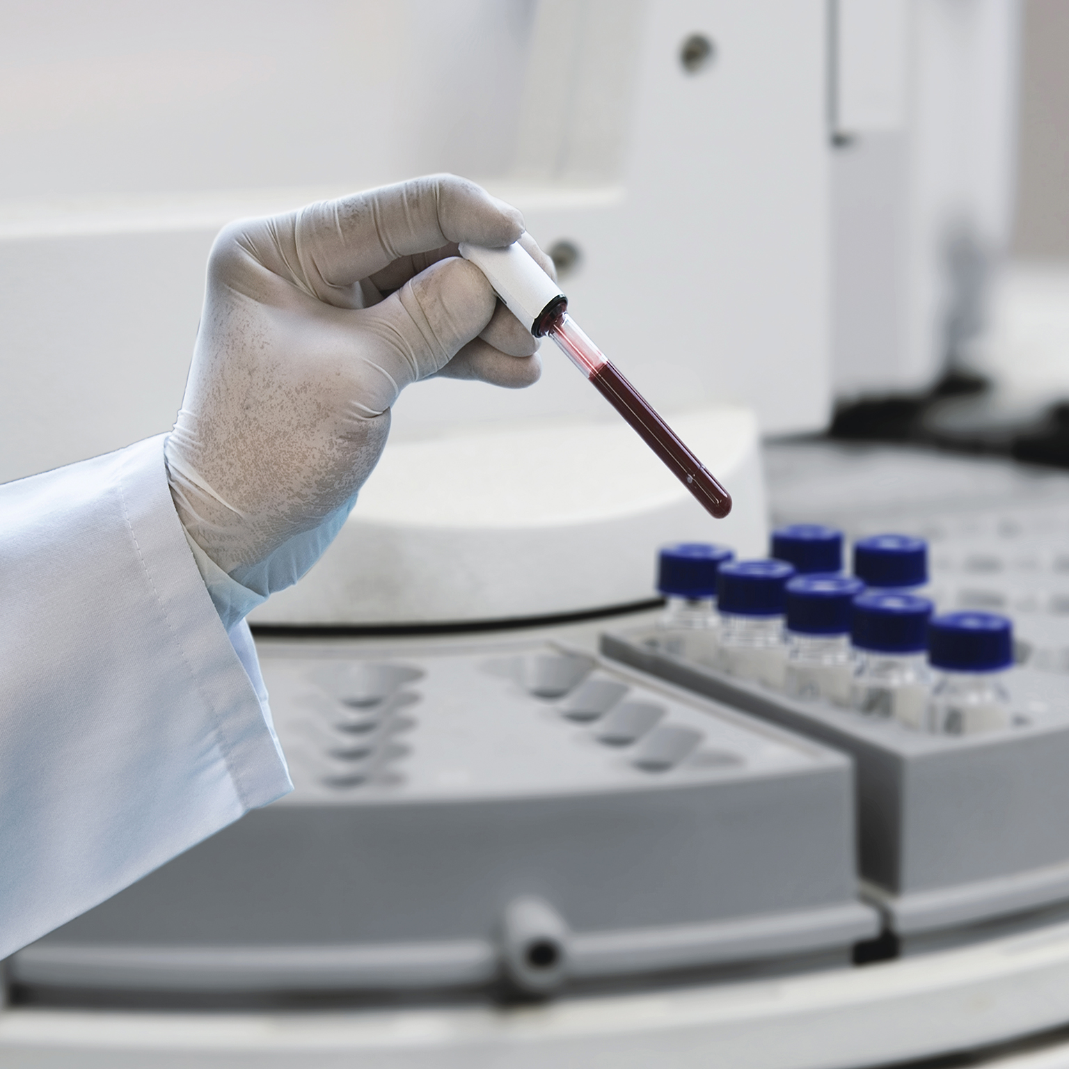 COVID-19 and in vitro diagnostics: New market forces at play